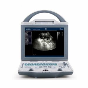 Rechargeable Human Ultrasound Scanner -KX5600